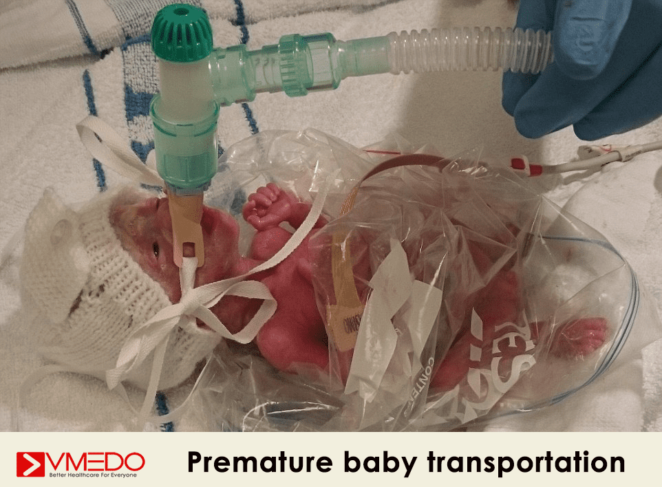 premature baby transportation