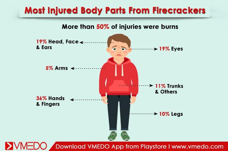injured_bodyparts-firecrackers