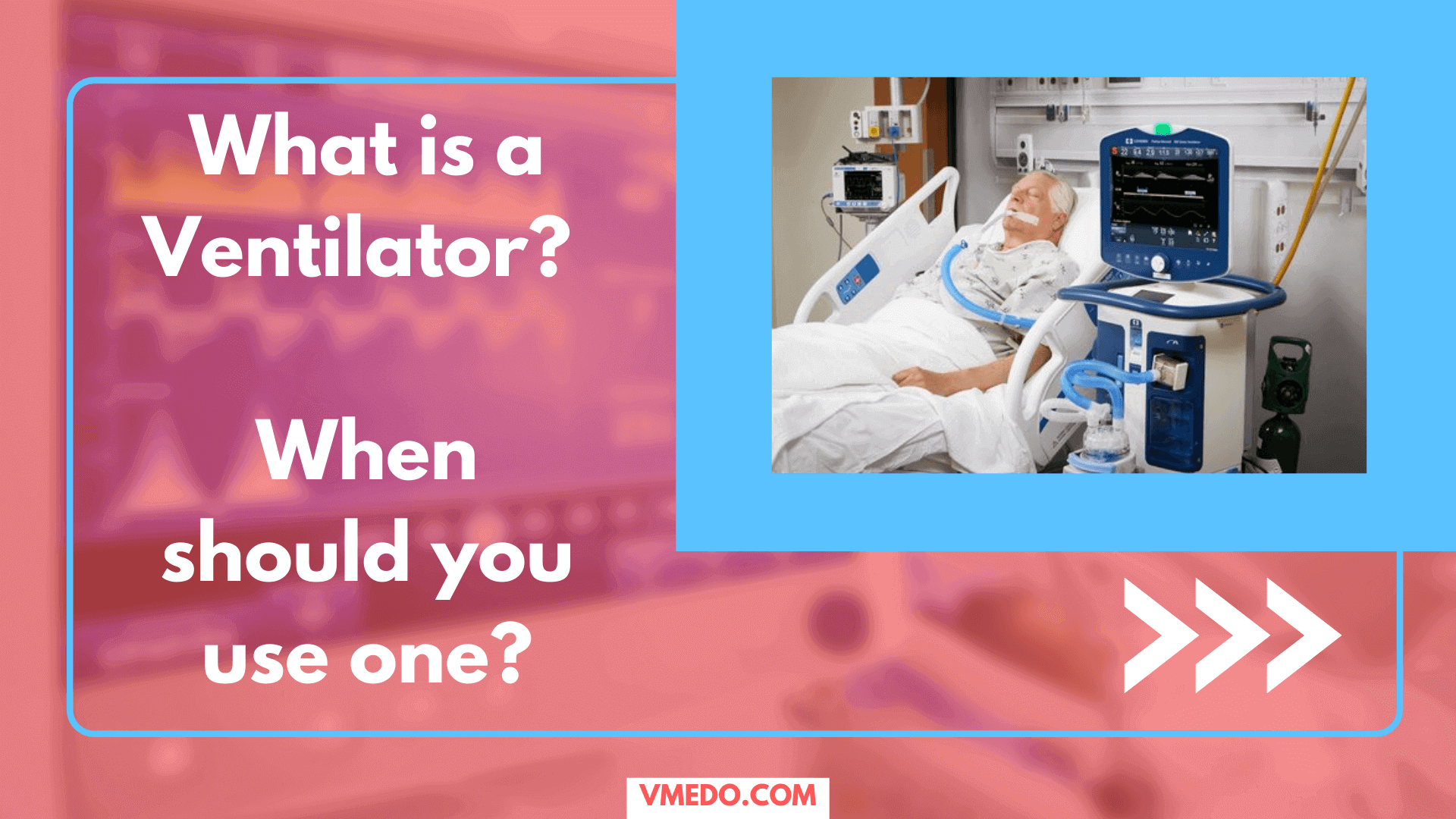 What is a Ventilator