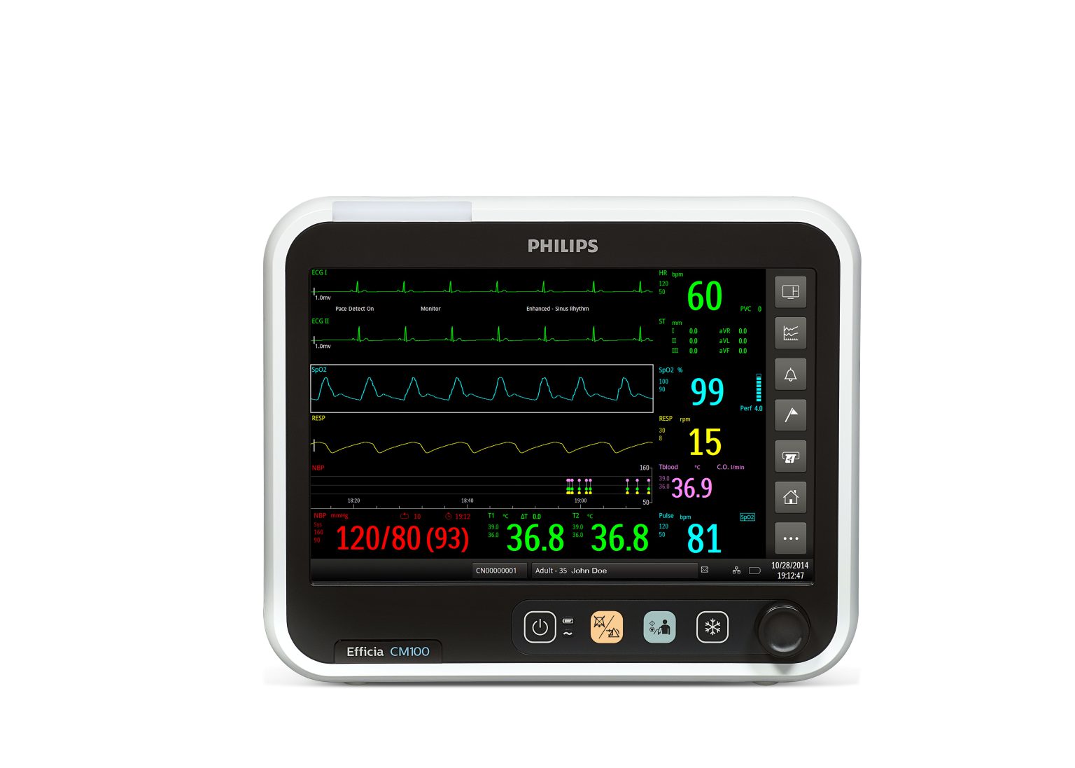 Top 10 Patient Monitors Available at Best Price In India - VMEDO Blog