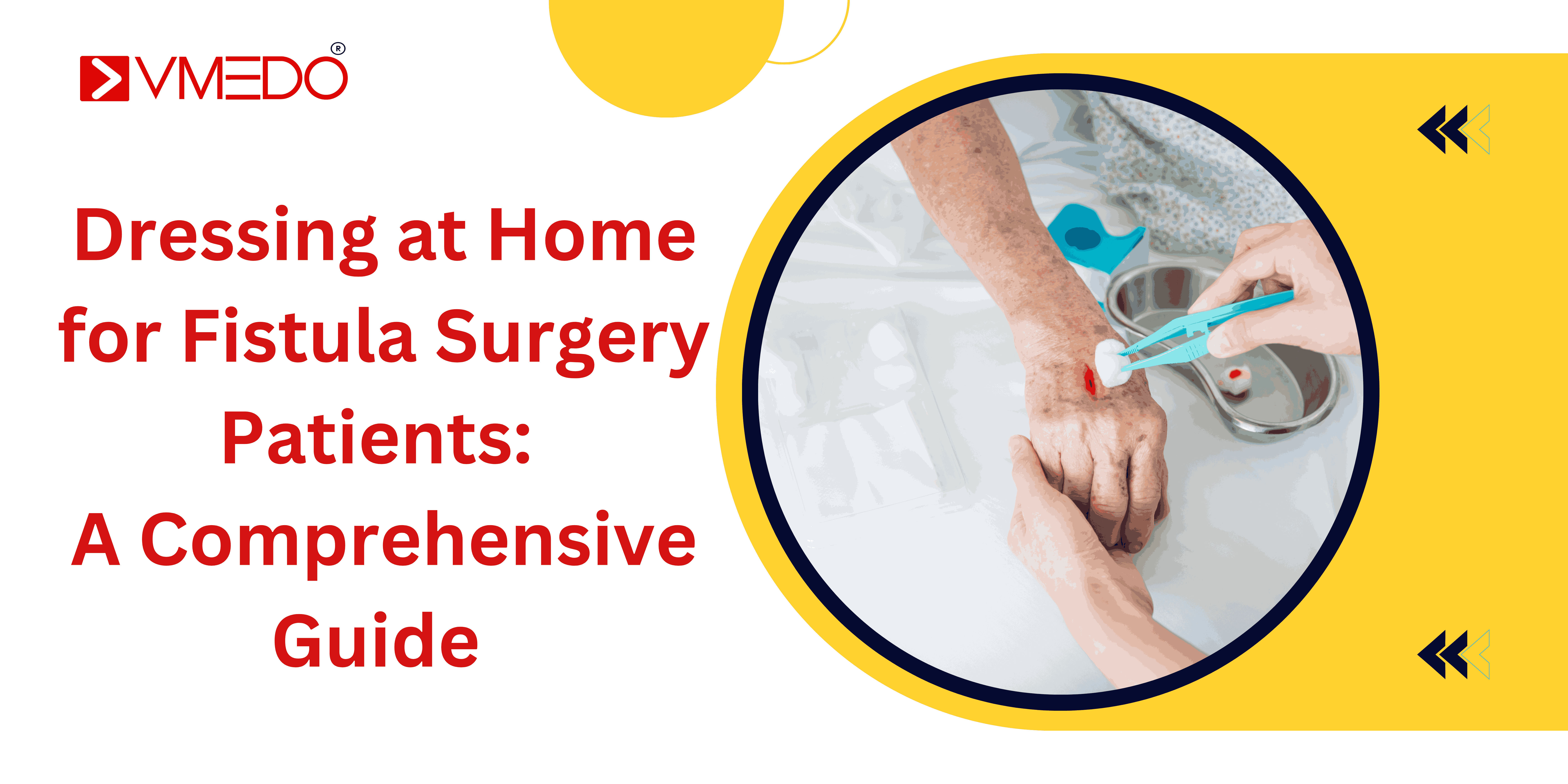 Dressing at home for fistula surgery patients: A comprehensive guide