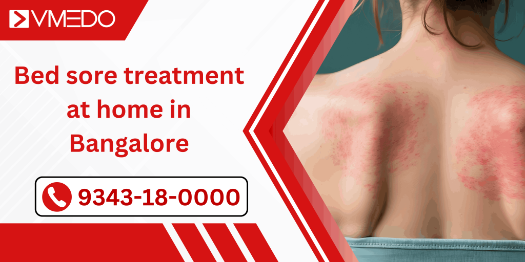 Bed sore treatment at home in Bangalore