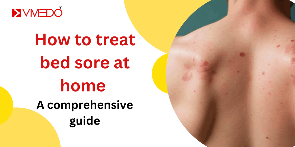 How to Treat Bed Sores at Home: A Comprehensive Guide