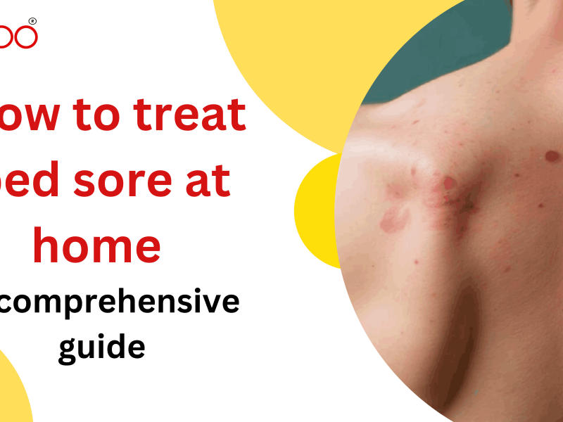 How to Treat Bed Sores at Home: A Comprehensive Guide