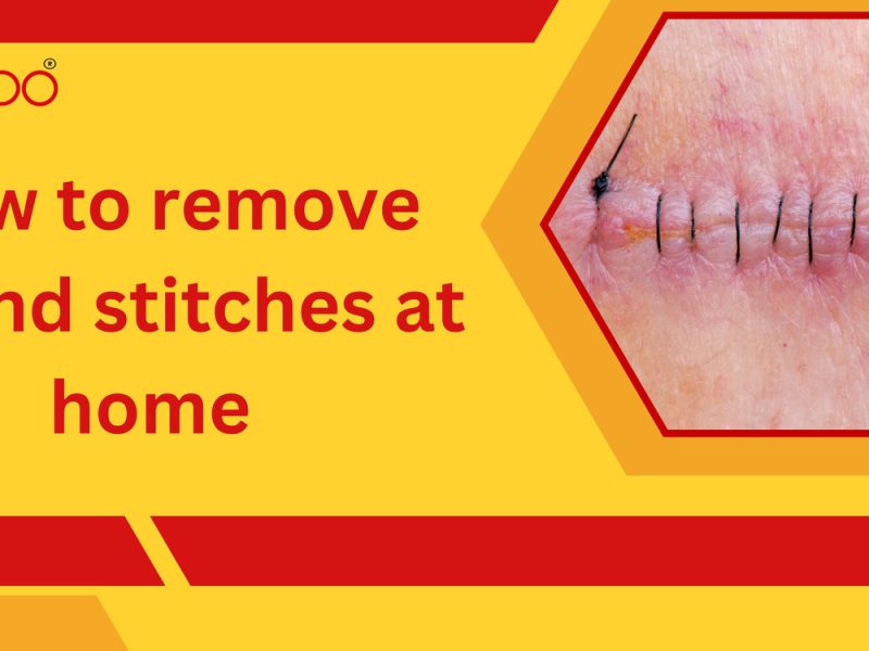 How to remove wound stitches at home