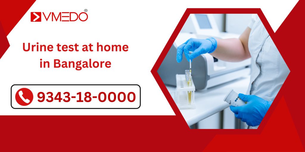 Urine-test-at-home-in-Bangalore