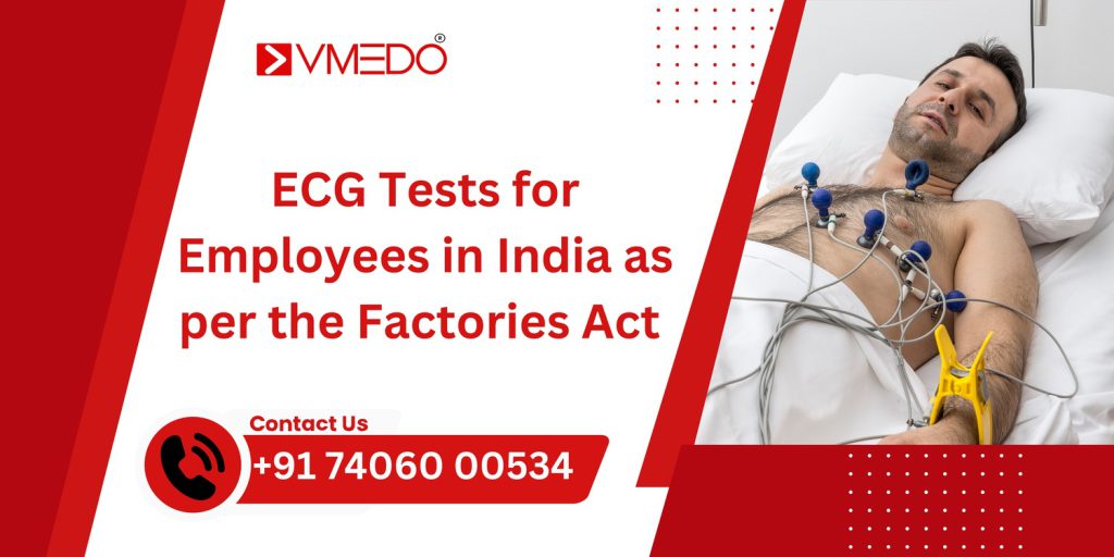 ECG Tests for Employees in India as per the Factories Act