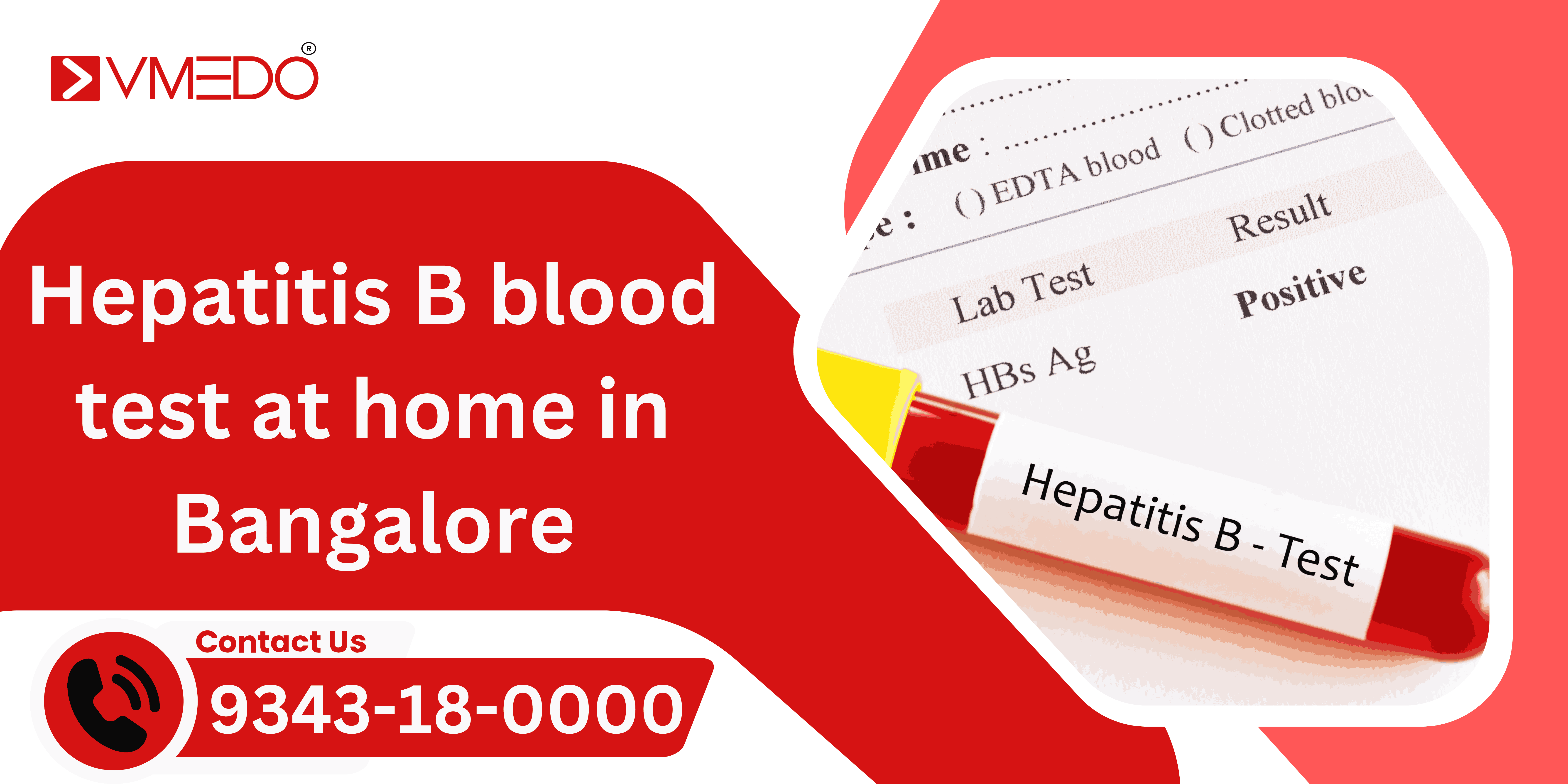 Hepatitis B Blood Test at Home In Bengaluru