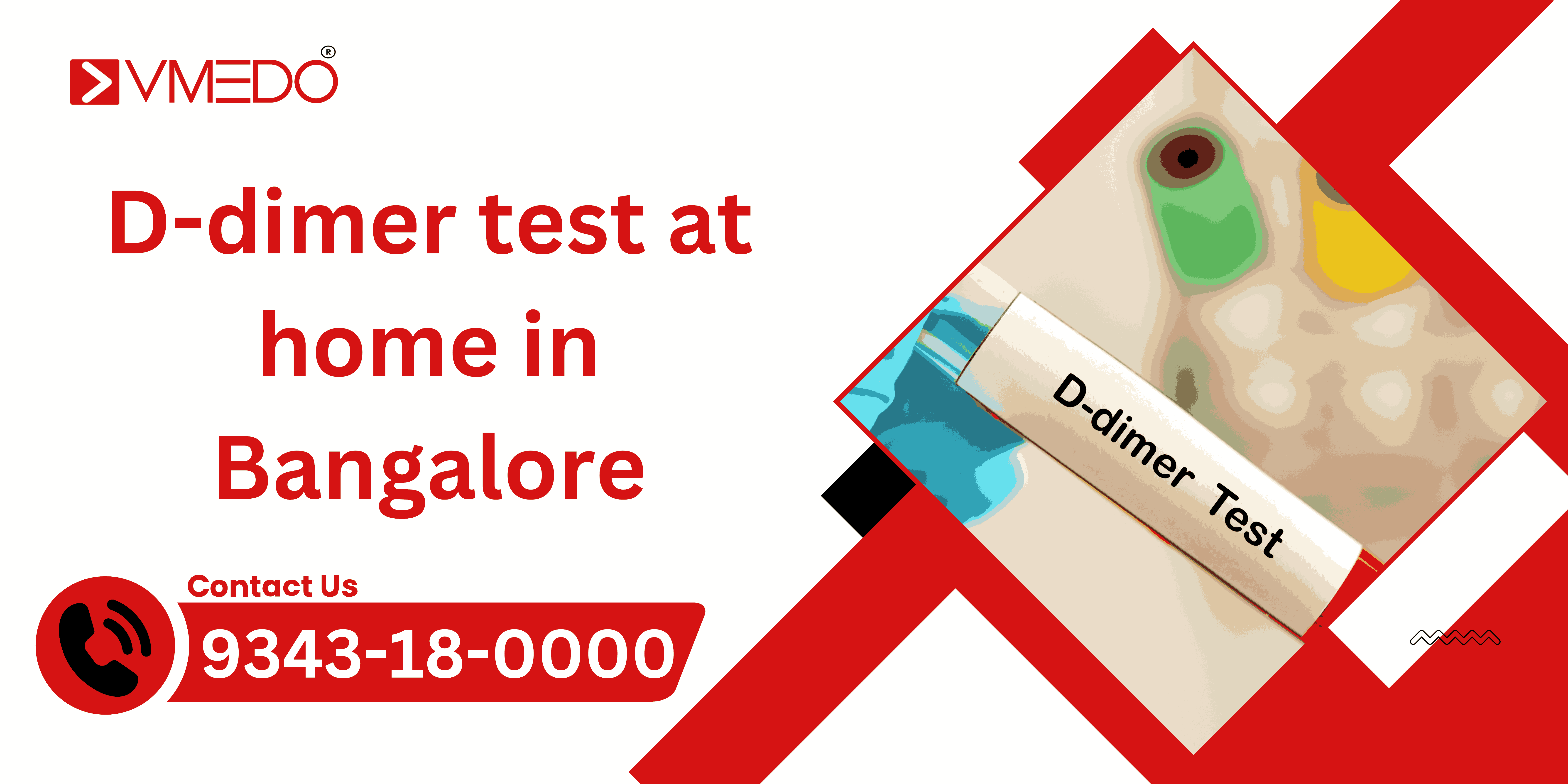 D-Dimer Test at Home in Bangalore