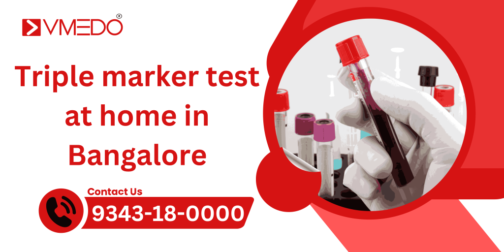 Triple marker test at home in Bangalore