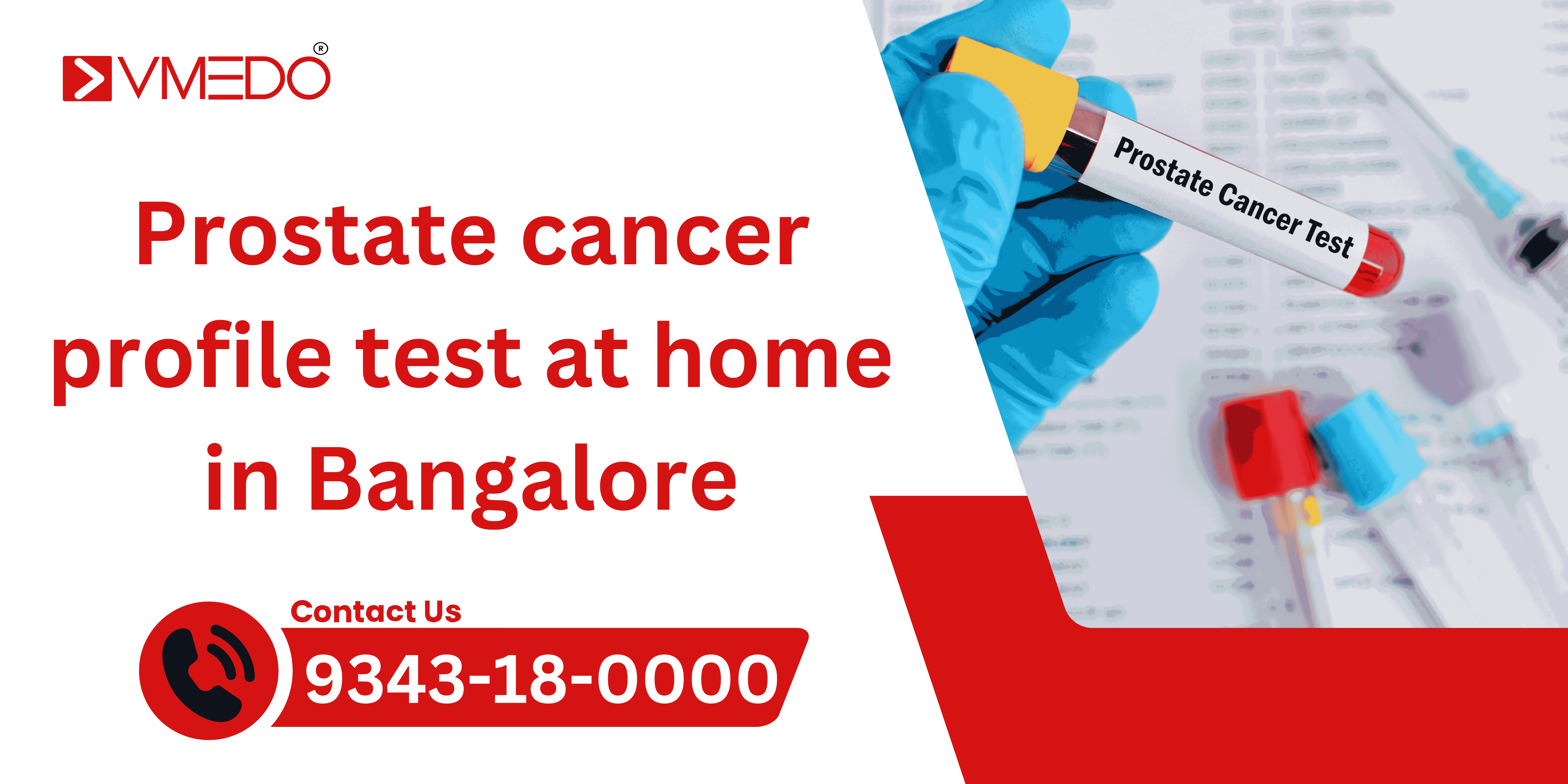 Prostate cancer profile test at home in Bangalore