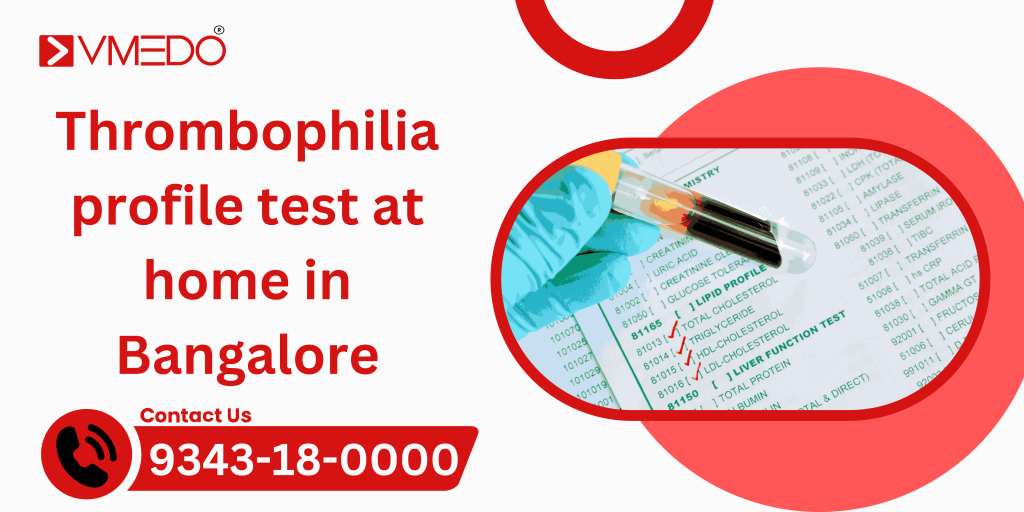 Thrombophilia Profile Test at Home Bengaluru