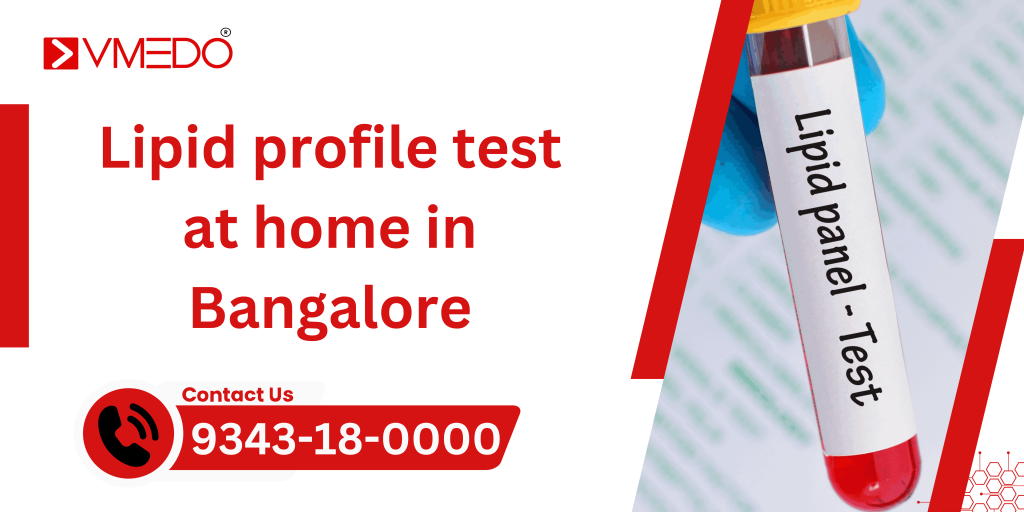 Lipid Profile Test at Home in Bangalore
