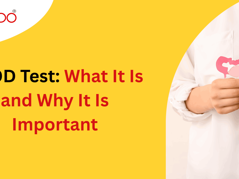 PCOD test: What it is and Why it is important?