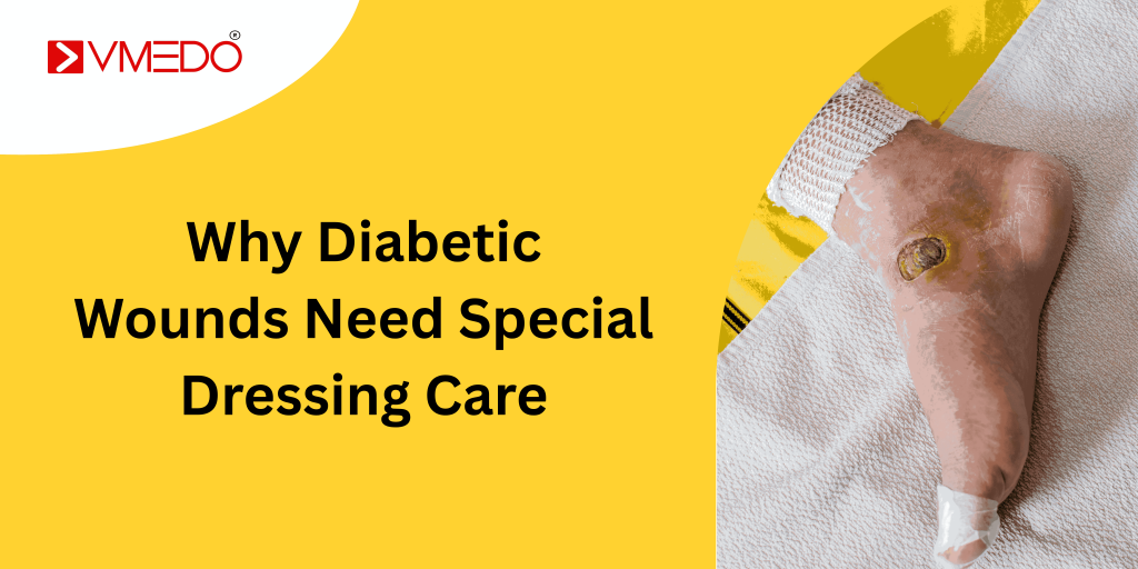 Why Diabetic Wounds Need Special Dressing Care