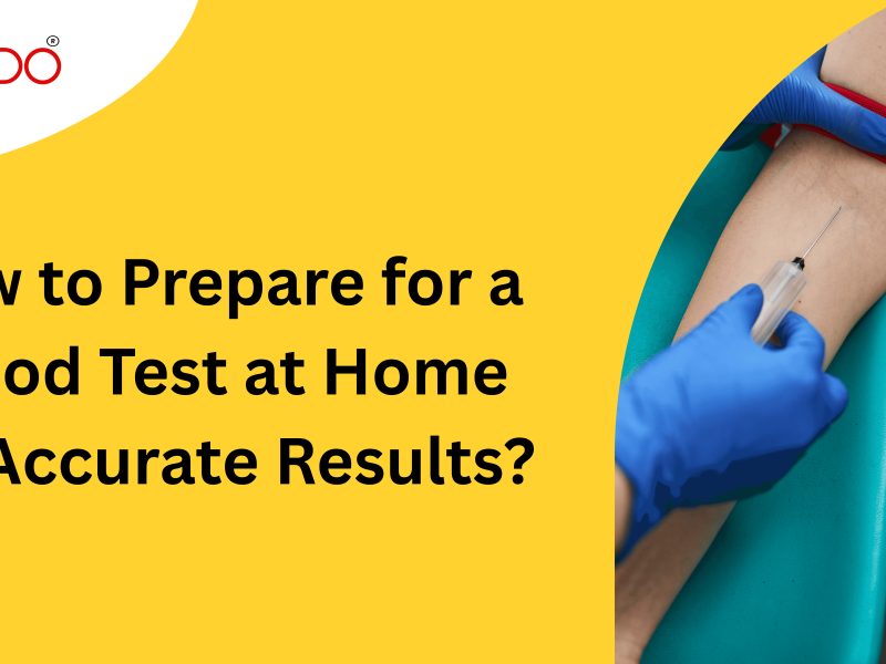 How to Prepare for a Blood Test at Home for Accurate Results