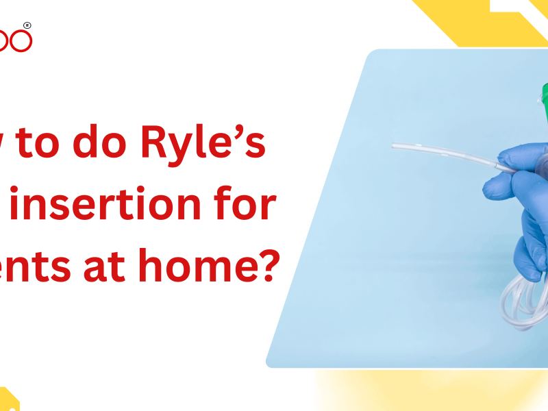 How to do Ryle’s tube insertion for patients at home