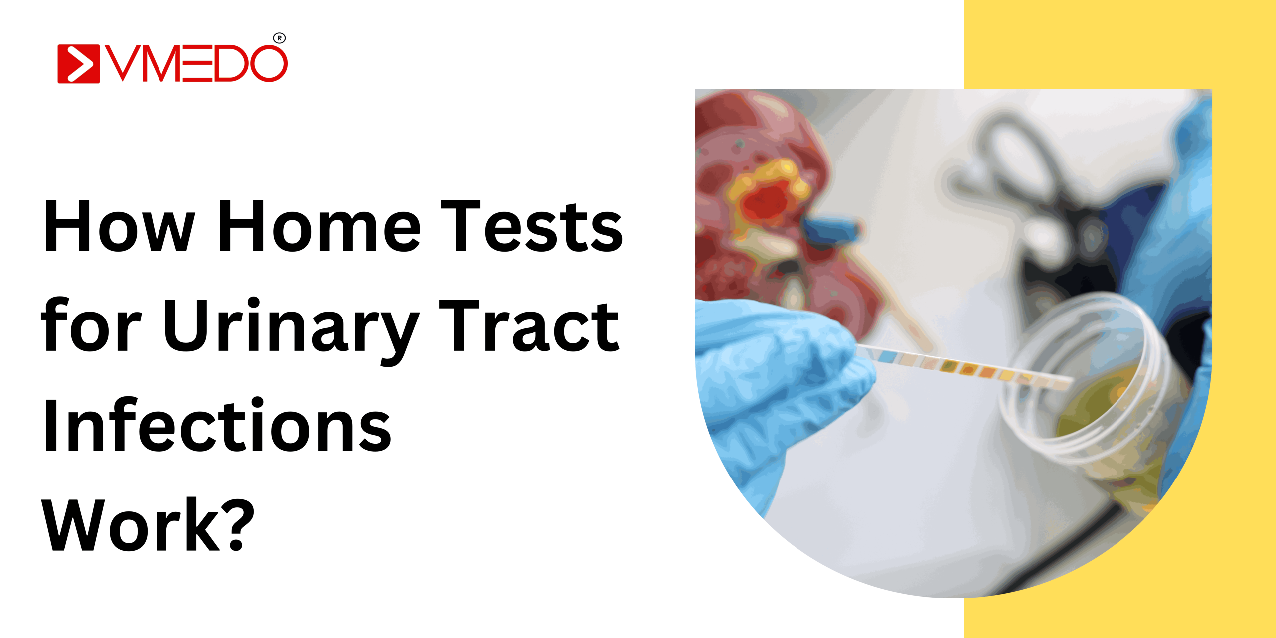 How Home Tests for Urinary Tract Infections (UTIs) Work