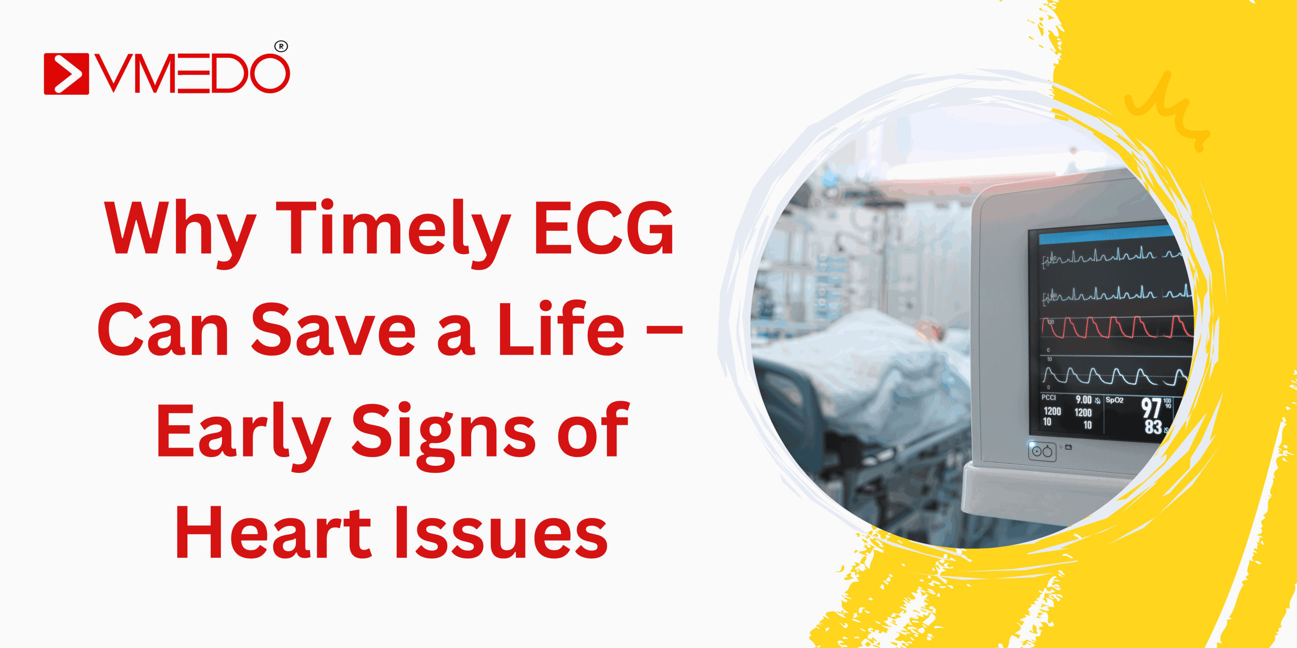 Why Timely ECG Can Save a Life – Early Signs of Heart Issues