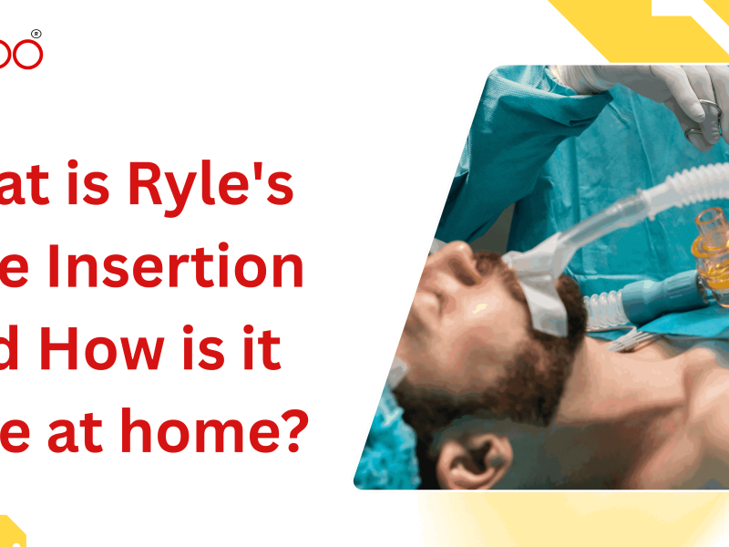 What is Ryle's Tube Insertion and How is it done at home?