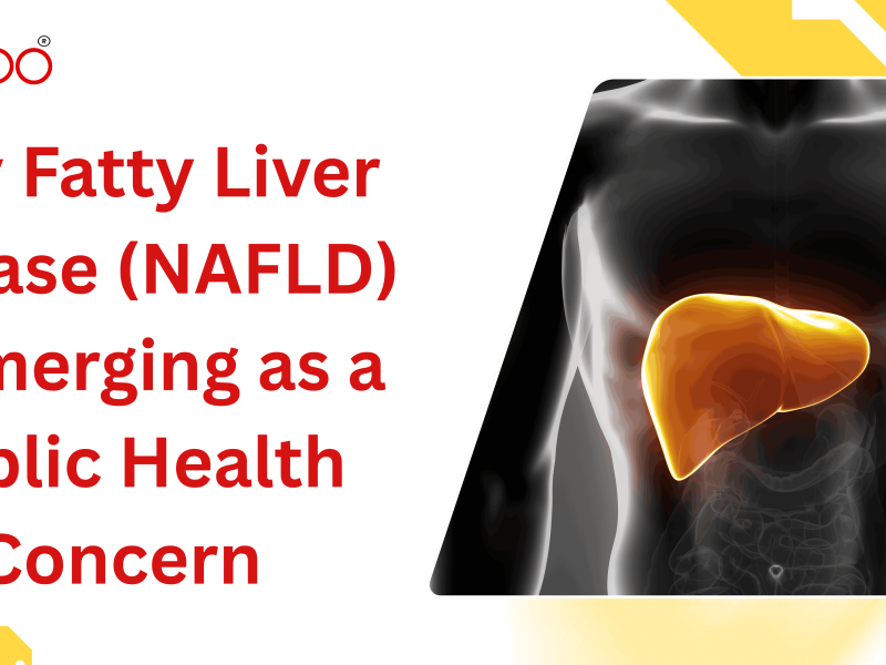 Why Fatty Liver Disease (NAFLD) Is Emerging as a Public Health Concern