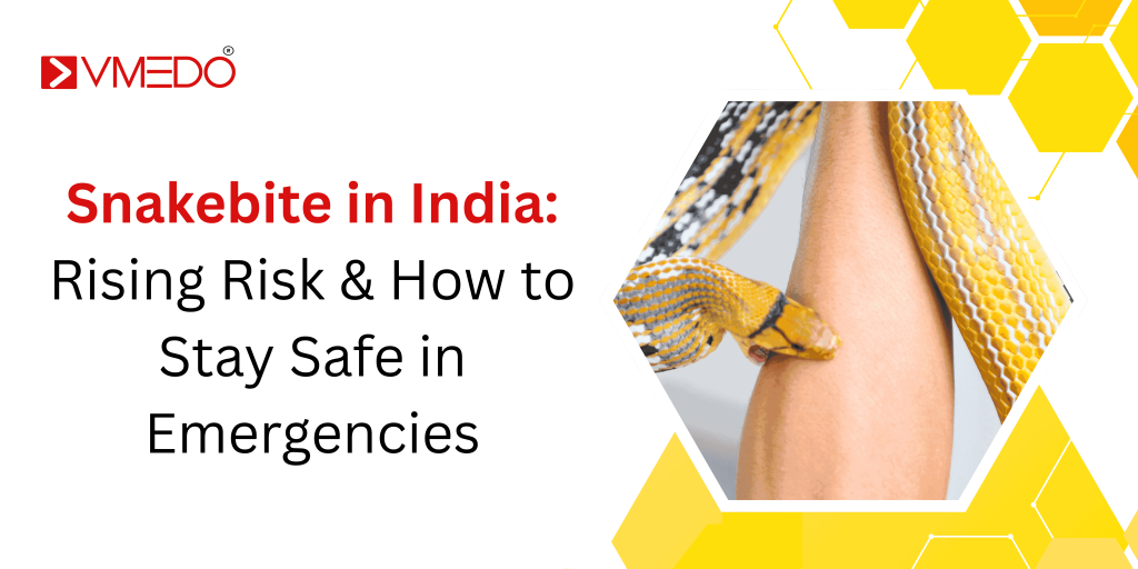 Snakebite in India: Rising Risk & How to Stay Safe in Emergencies